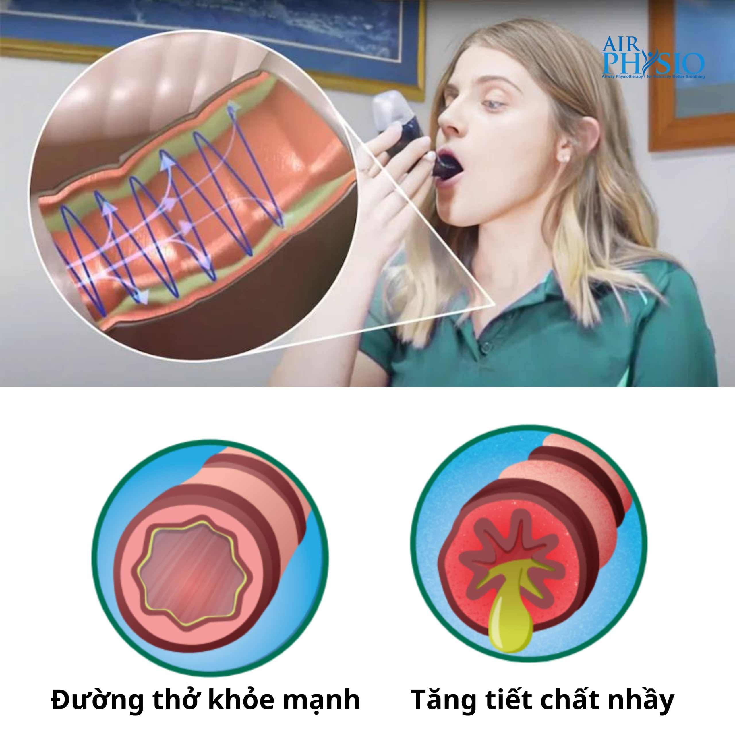 Cảm nhận hiệu quả Airphysio